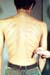 1970_06_vietnam_Hill_37_Meningitis_swan